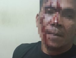 Penyidik Polsek Ternate Utara Didesak Tetapkan Tersangka Kasus Penganiayaan dan Pengeroyokan di Akehuda