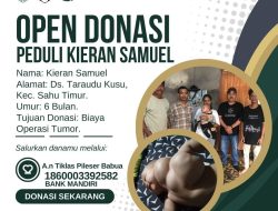 GMKI dan GMNI Salurkan Bantuan Untuk Bayi Penderita Tumor di Desa Tarkus Halmahera Barat