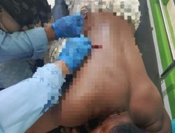 Seorang Warga Desa Dote Halteng Diserang OTK, Korban Diduga Terkena Busur Anak Panah