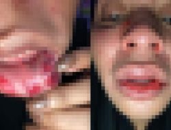 Oknum Polisi di Ternate Aniaya Kekasihnya Gegara Ditanya Kapan Nikah