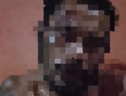 Tak Terima Dianiaya, Warga Desa Bisui Halmahera Selatan akan Polisikan Dua Pelaku