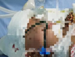 Bayi 8 Bulan Asal Halsel Butuh Uluran Tangan Untuk Jalani Operasi Kepala Kedua di RS Tobelo